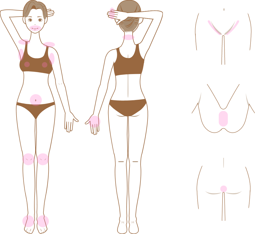 女性脱毛箇所説明イラスト01