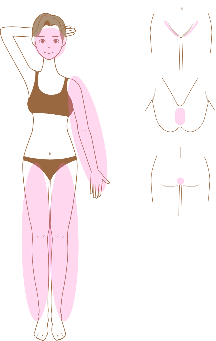 女性脱毛箇所説明イラスト04