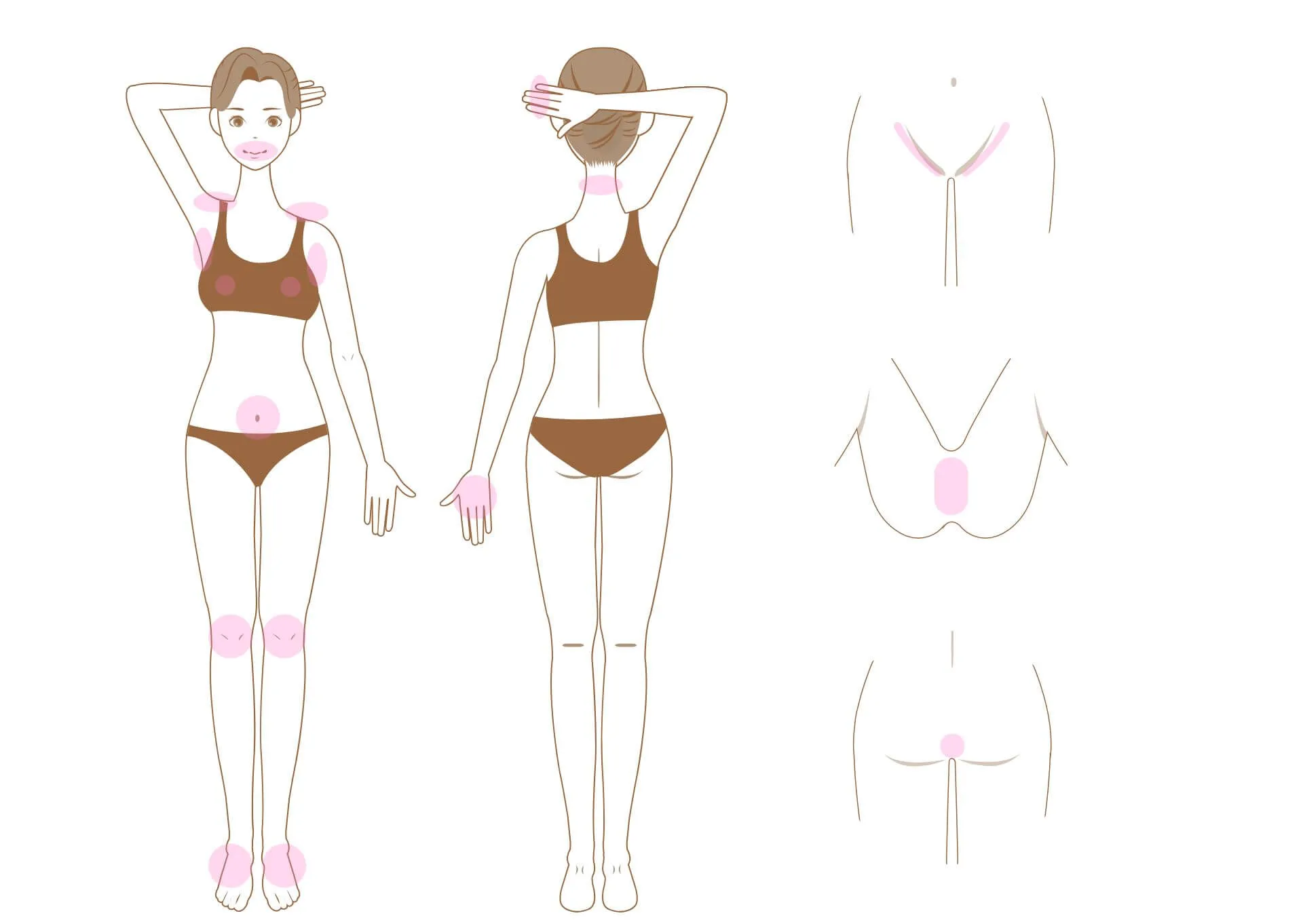 脱毛箇所説明画像